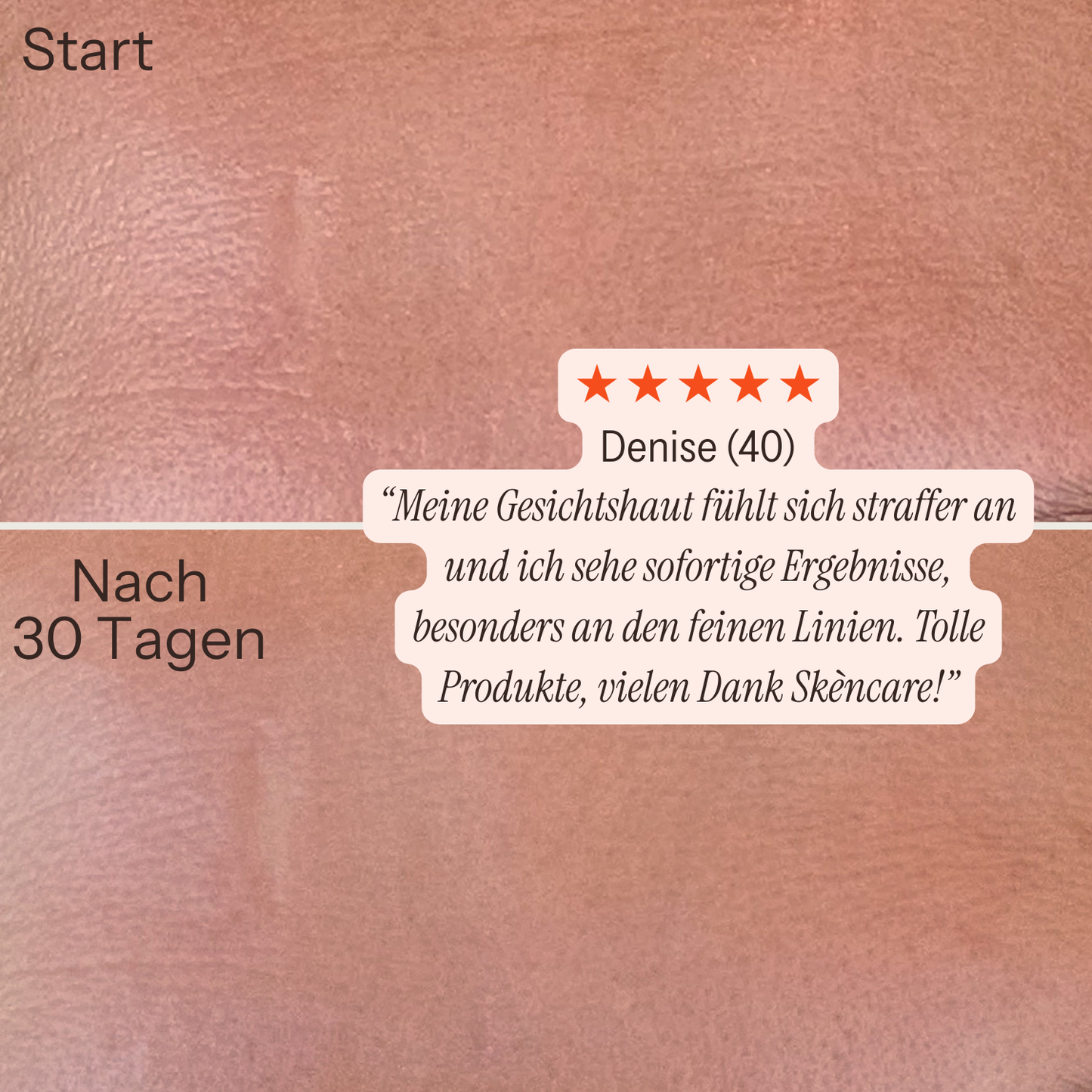 [lang:de]