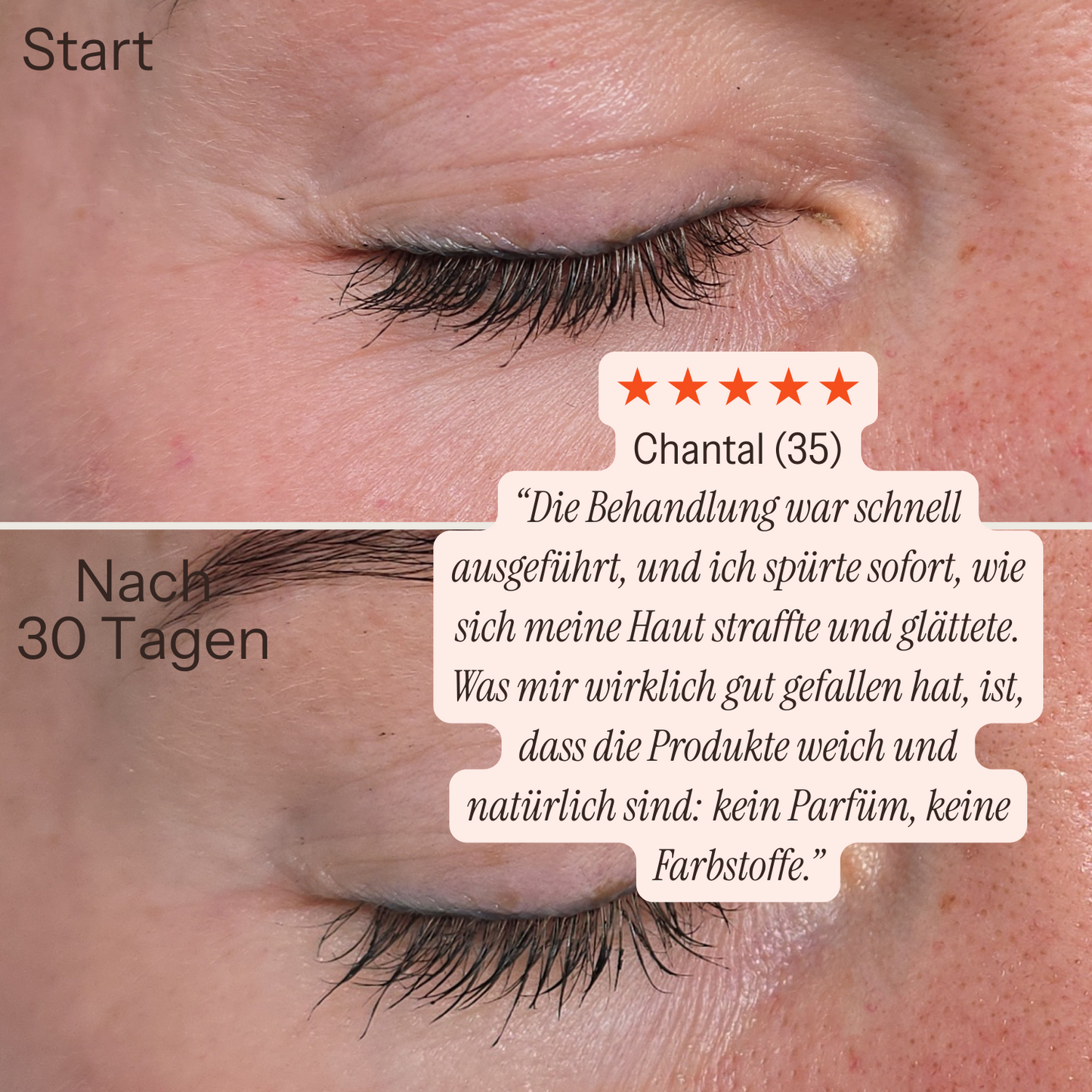 [lang:de]