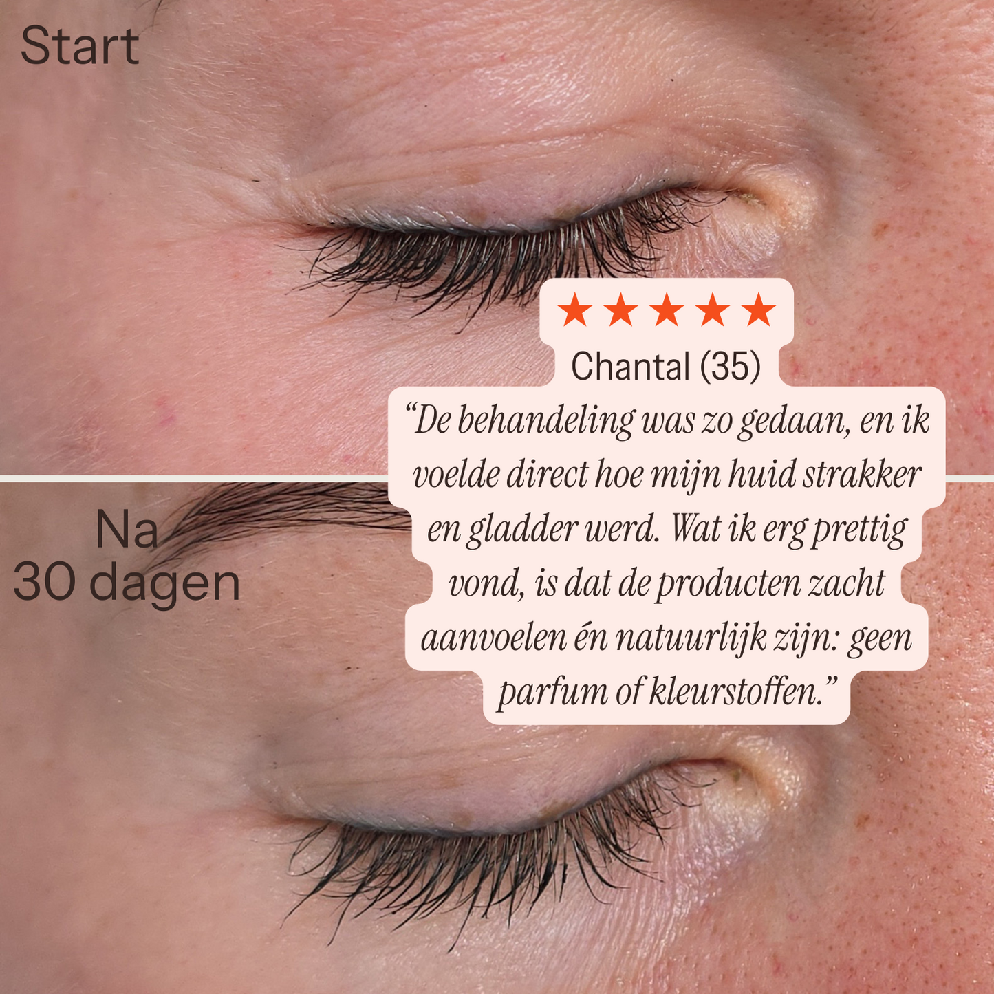 [lang:nl]