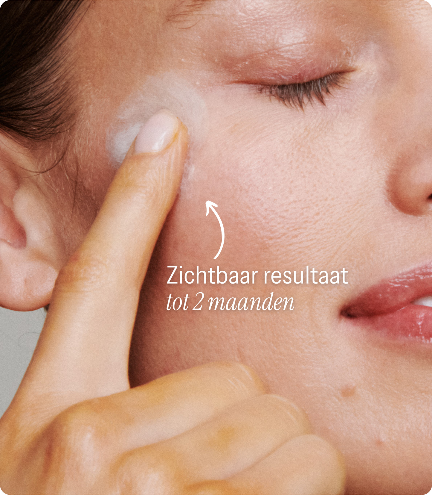 [lang:nl]