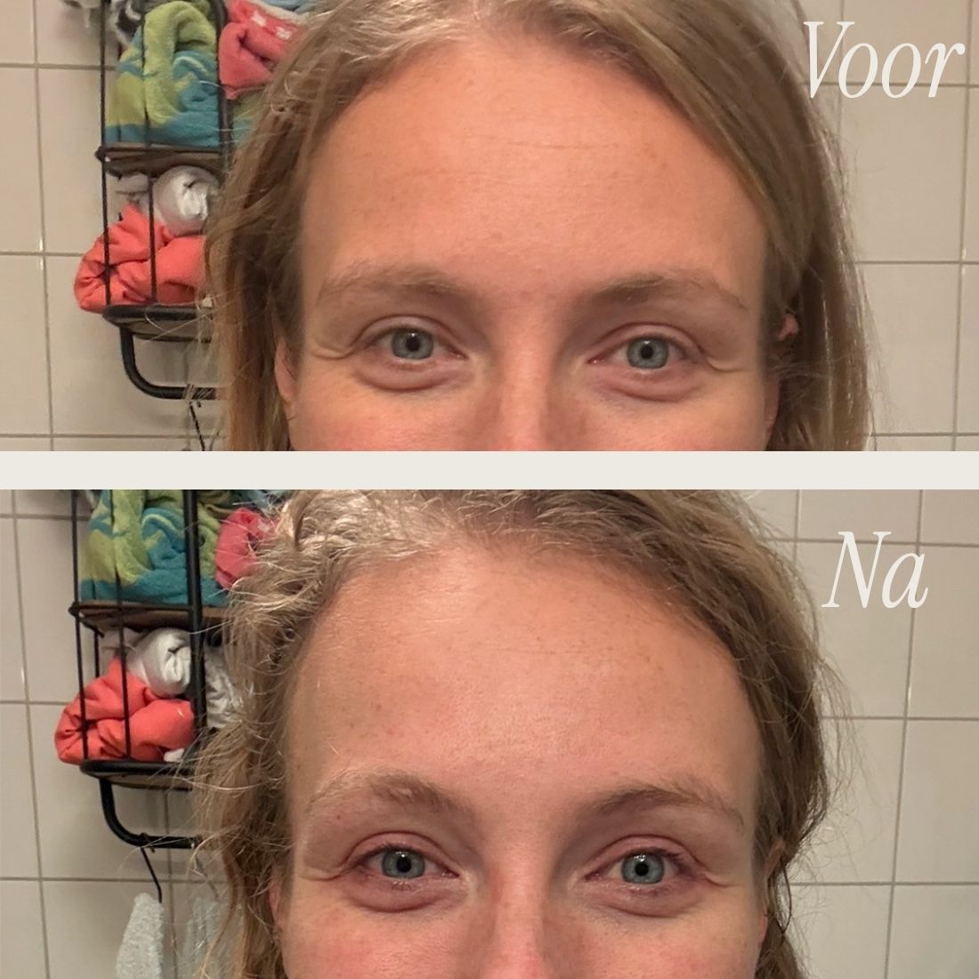 [lang:nl]